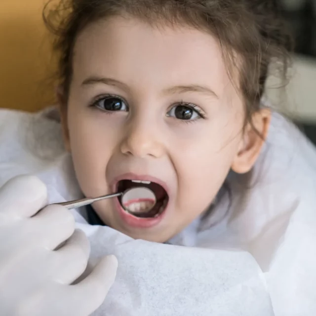 Little girl looking at camera with someone using a dental mirror in her mouth
